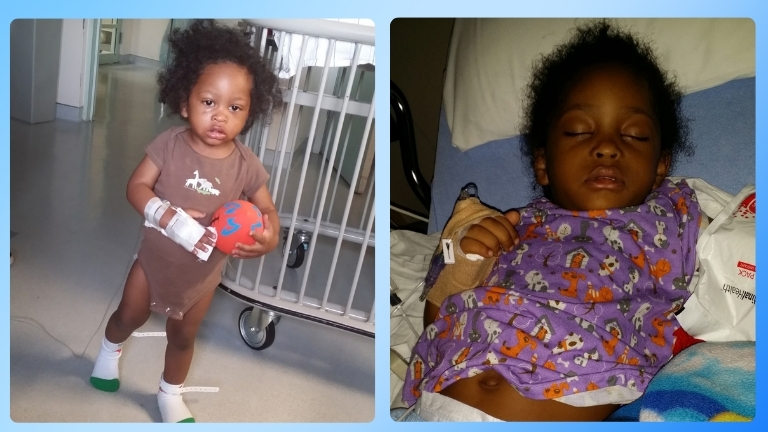 Isaac first two hospital stays for sickle cell disease.