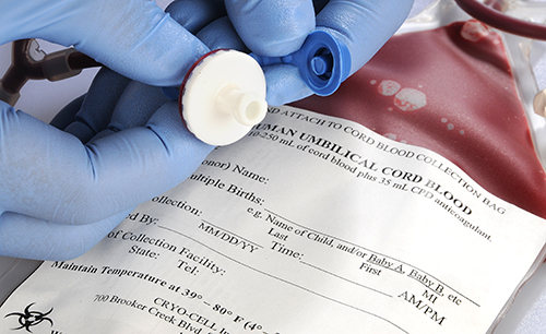 How To Get The Best Cord Blood Collection