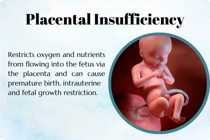 Placental Insufficiency: What Every Expectant Parent Should Know